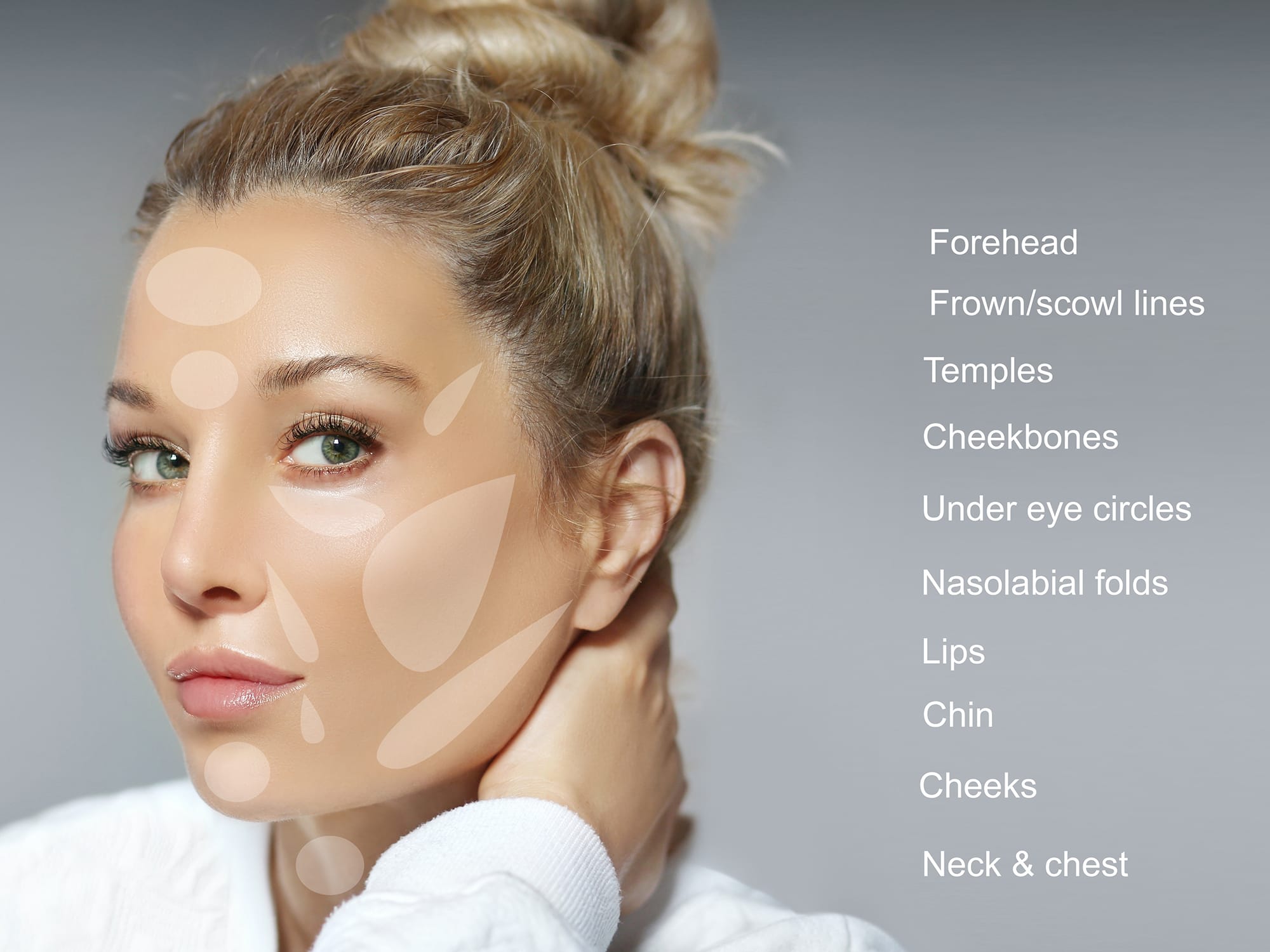 Dermal filler injection for facial contouring